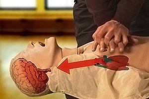 History of CPR